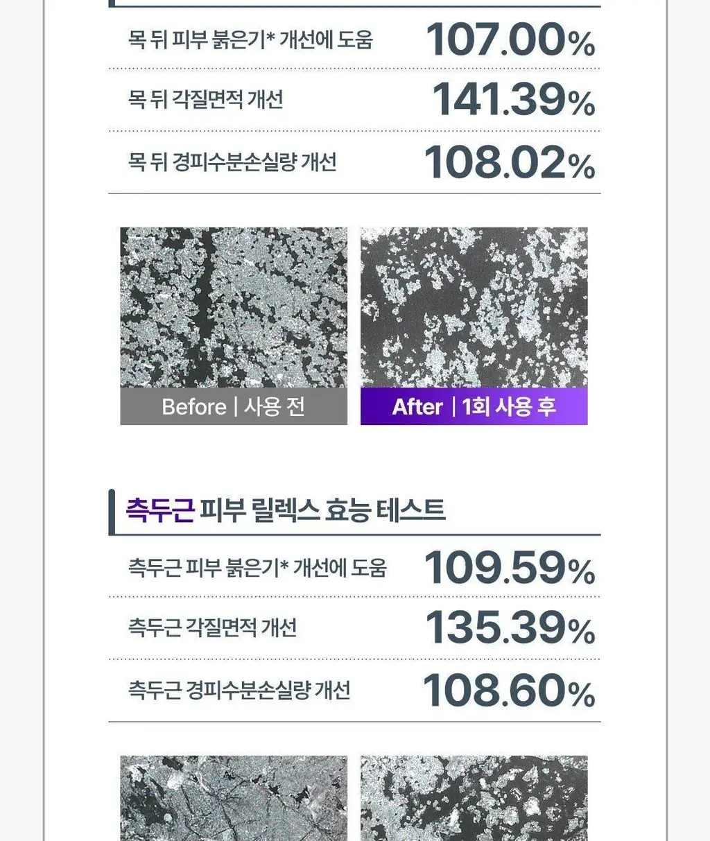 [No.1 헤어/두피 디바이스] 레스노베 하이퍼샷(베이지/핑크) 상세페이지 28